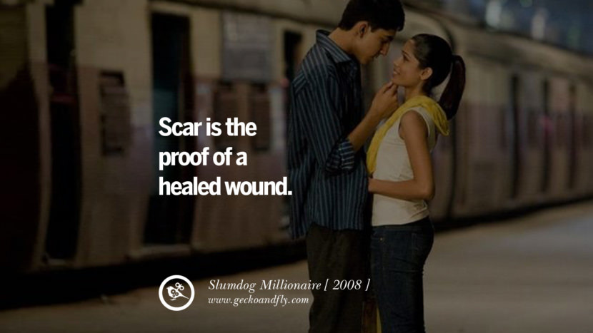 Slumdog Millionaire Scar is the proof of a healed wound.